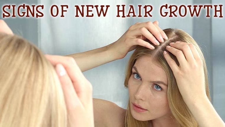 Hair Growth Supplements Can Work – Know about the working 