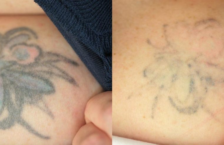 What Are The Benefits Of Using Tattoo Numbering Cream?
